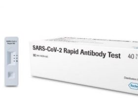 ロシュ・ダイア、専用の装置を使わずに新型コロナウイルスのIgG抗体およびIgM抗体を同時に検出する研究用試薬を発売