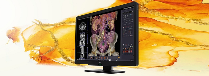 JVCケンウッド、医用画像表示モニター「i3シリーズ」から30型・600万画素カラー液晶モニター「CL-S600」