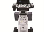 GEヘルスケア・ジャパン、汎用超音波画像診断装置「LOGIQ Fortis」を発売