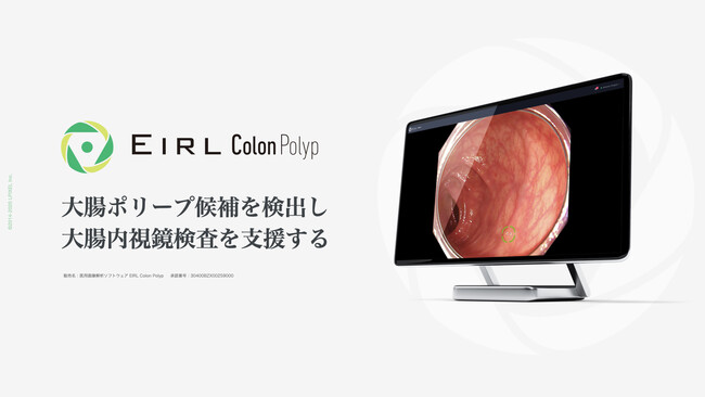 LPIXEL、大腸内視鏡検査を支援する「医用画像解析ソフトウェアEIRL Colon Polyp」を発売