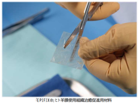 グンゼ、グンゼメディカルよりヒト由来の羊膜使用組織治癒促進用材料「EPIFIX」を販売開始