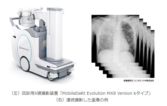 島津製作所、回診用X線撮影装置「MobileDaRt Evolution MX8 Version kタイプ」を発売